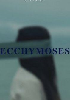 Ecchymoses - Carelle D